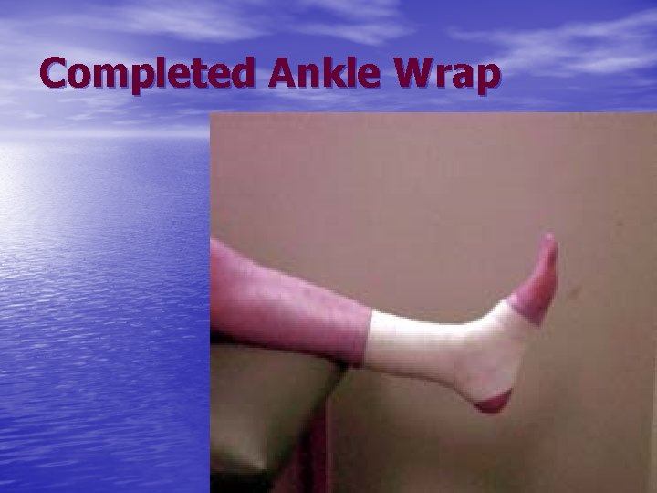 Completed Ankle Wrap 