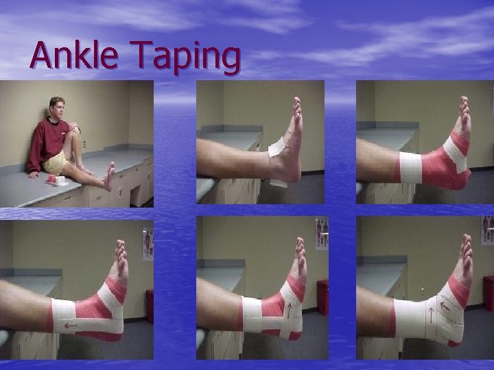 Ankle Taping 