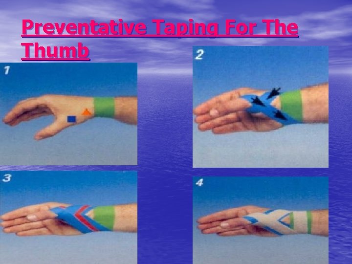 Preventative Taping For The Thumb 