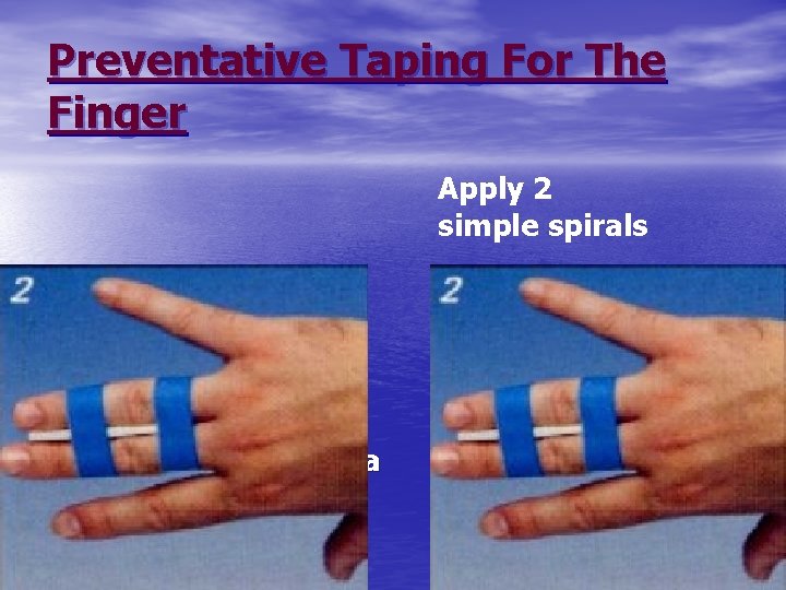 Preventative Taping For The Finger Apply 2 simple spirals • Use next finger as