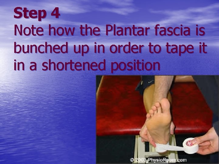 Step 4 Note how the Plantar fascia is bunched up in order to tape