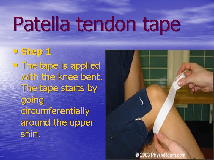 Patella tendon tape • Step 1 • The tape is applied with the knee