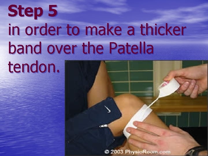 Step 5 in order to make a thicker band over the Patella tendon. 