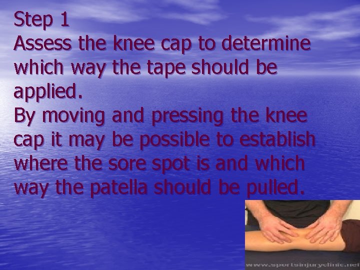 Step 1 Assess the knee cap to determine which way the tape should be