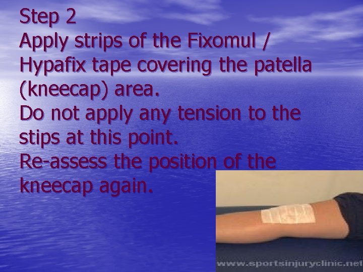 Step 2 Apply strips of the Fixomul / Hypafix tape covering the patella (kneecap)