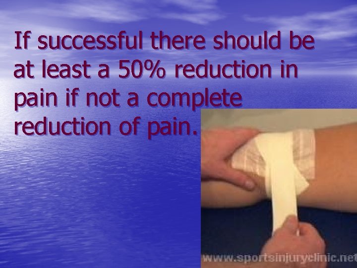 If successful there should be at least a 50% reduction in pain if not