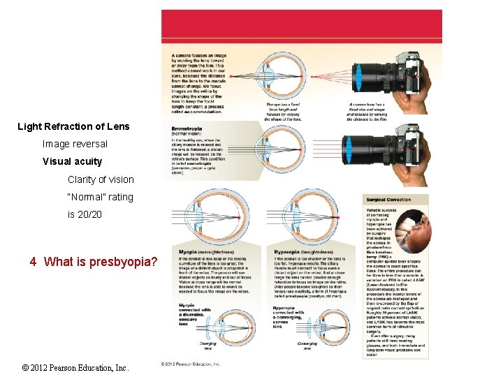 Light Refraction of Lens Image reversal Visual acuity Clarity of vision “Normal” rating is