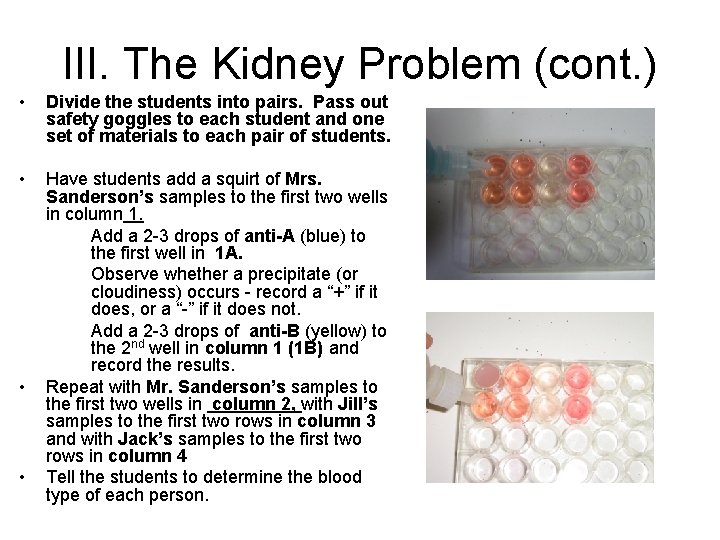 III. The Kidney Problem (cont. ) • Divide the students into pairs. Pass out