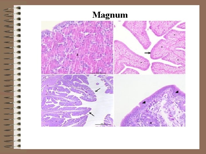 Magnum 