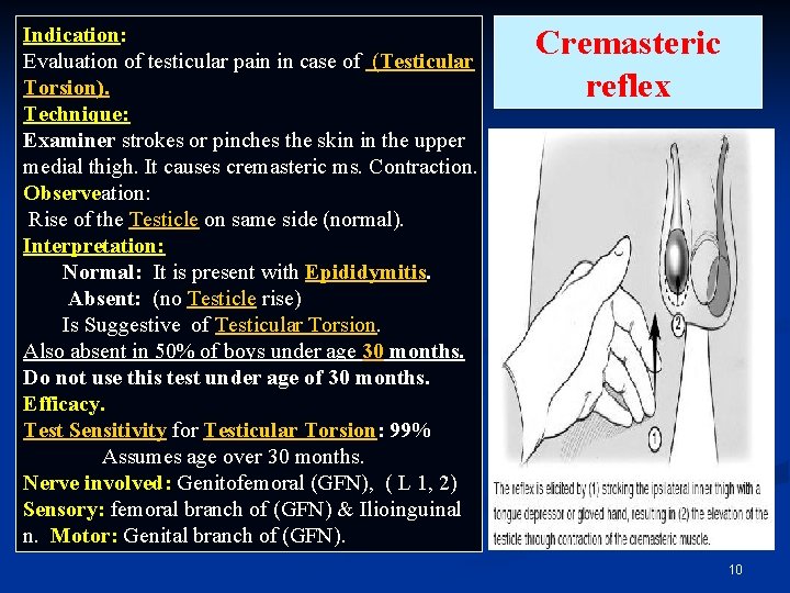 Indication: Evaluation of testicular pain in case of (Testicular Torsion). Technique: Examiner strokes or Indication: Evaluation of testicular pain in case of (Testicular Torsion). Technique: Examiner strokes or