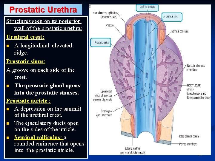 Prostatic Urethra Structures seen on its posterior wall of the prostatic urethra: Urethral crest: Prostatic Urethra Structures seen on its posterior wall of the prostatic urethra: Urethral crest: