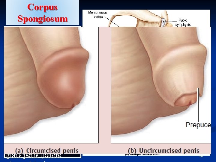 Corpus Spongiosum §The single inferior mass (Secondary erectile tissue) §It is traversed by the Corpus Spongiosum §The single inferior mass (Secondary erectile tissue) §It is traversed by the