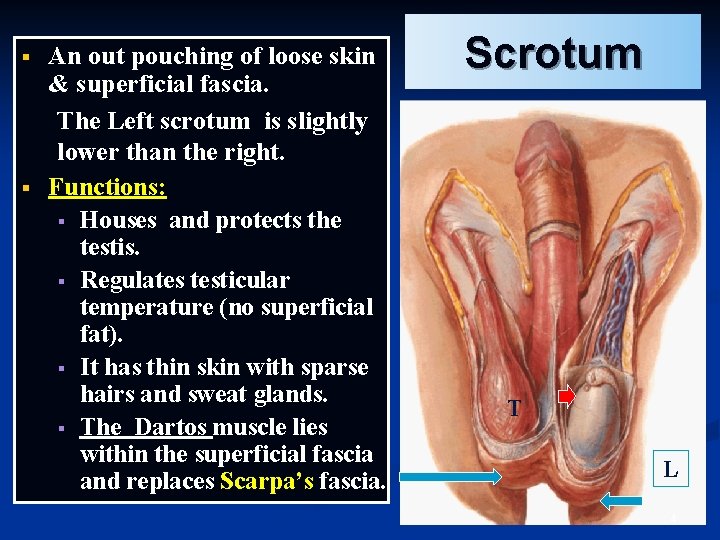 § § An out pouching of loose skin & superficial fascia. The Left scrotum § § An out pouching of loose skin & superficial fascia. The Left scrotum