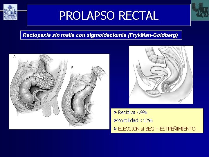 PROLAPSO RECTAL Rectopexia sin malla con sigmoidectomía (Fryk. Man-Goldberg) Ø Recidiva <9% ØMorbilidad <12%
