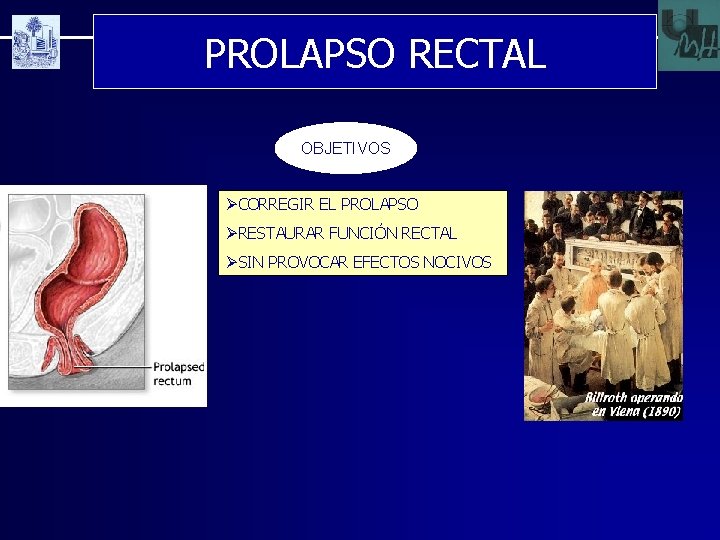 PROLAPSO RECTAL OBJETIVOS ØCORREGIR EL PROLAPSO ØRESTAURAR FUNCIÓN RECTAL ØSIN PROVOCAR EFECTOS NOCIVOS 