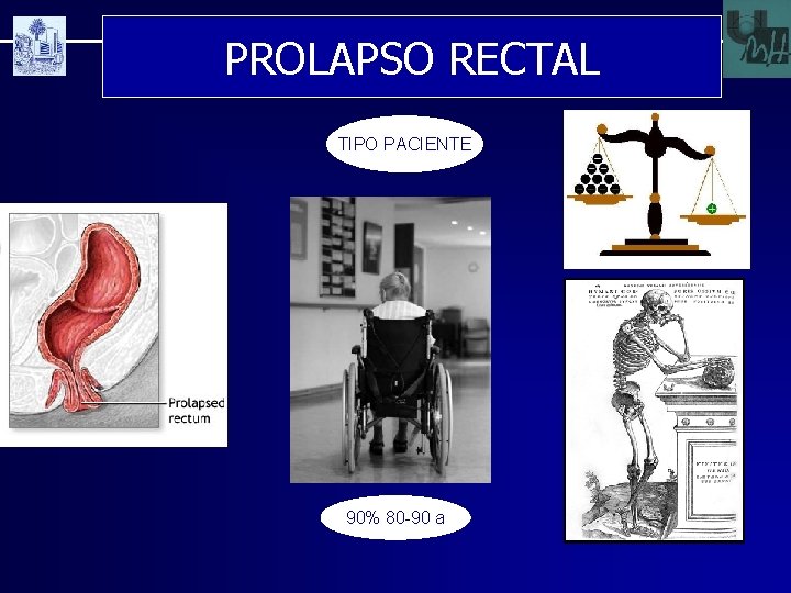 PROLAPSO RECTAL TIPO PACIENTE 90% 80 -90 a 