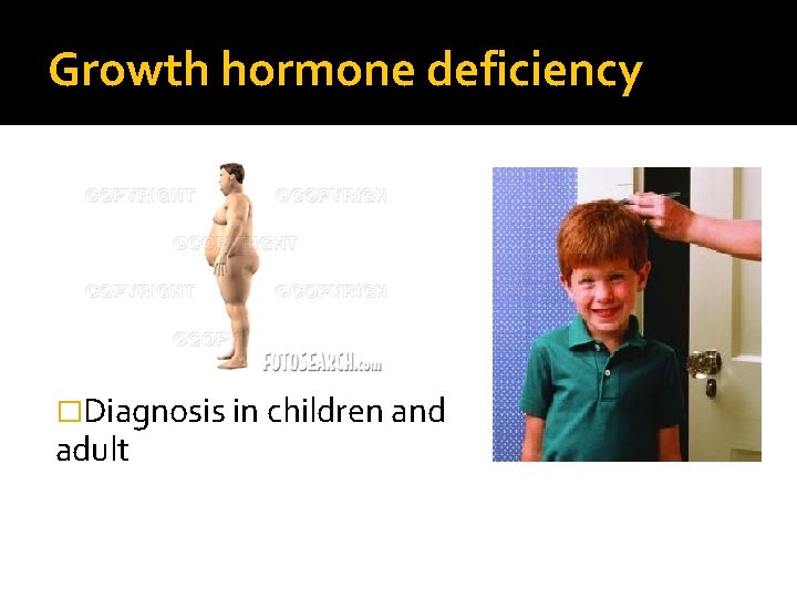 Growth hormone deficiency �Diagnosis in children and adult 