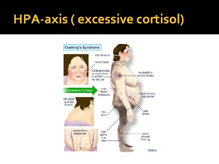 HPA-axis ( excessive cortisol) 
