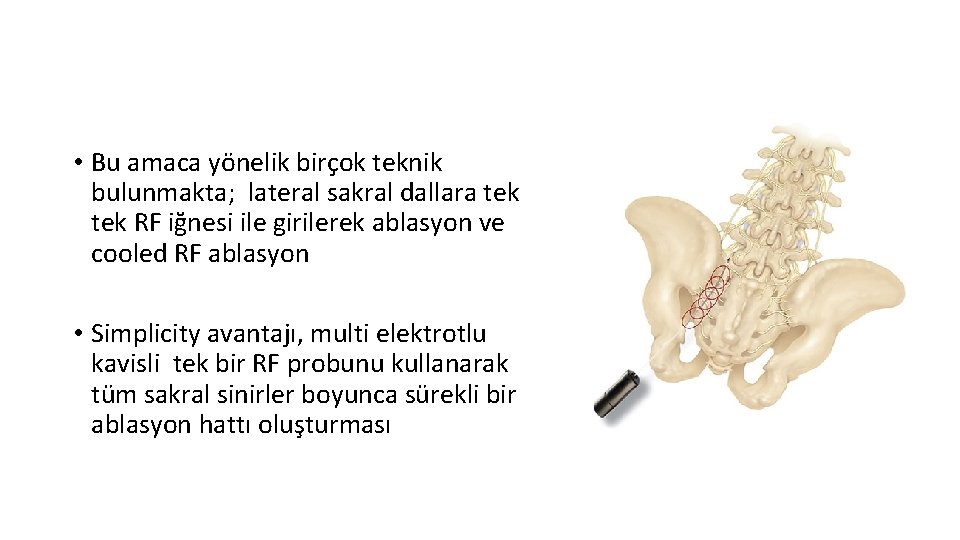  • Bu amaca yönelik birçok teknik bulunmakta; lateral sakral dallara tek RF iğnesi