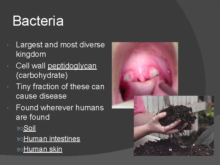 Bacteria Largest and most diverse kingdom Cell wall peptidoglycan (carbohydrate) Tiny fraction of these