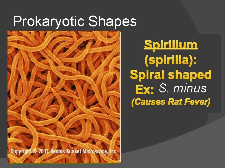 Prokaryotic Shapes Coccus Spirillum Bacillus (cocci): (spirilla): (bacilli): Spherical Spiral shaped Rod shaped Ex: