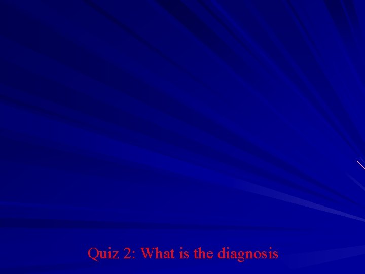 Quiz 2: What is the diagnosis 