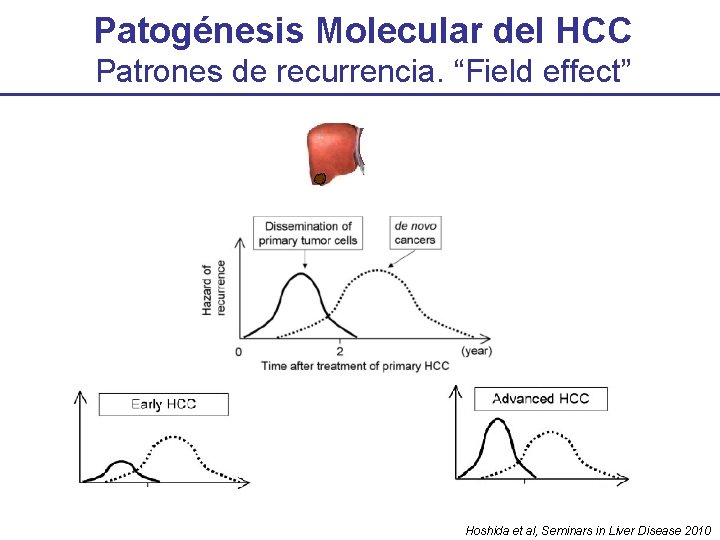 Patogénesis Molecular del HCC Patrones de recurrencia. “Field effect” Hoshida et al, Seminars in