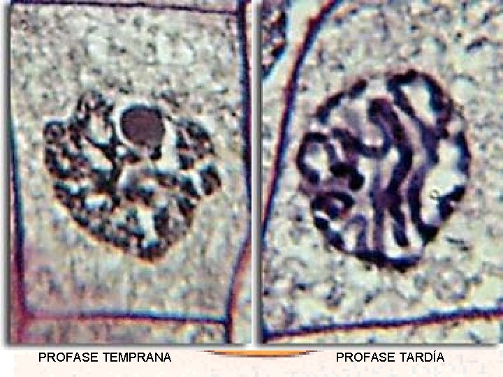 PROFASE TEMPRANA PROFASE TARDÍA 