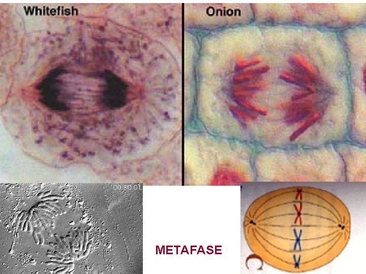 METAFASE 