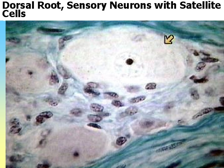 Dorsal Root, Sensory Neurons with Satellite Cells 