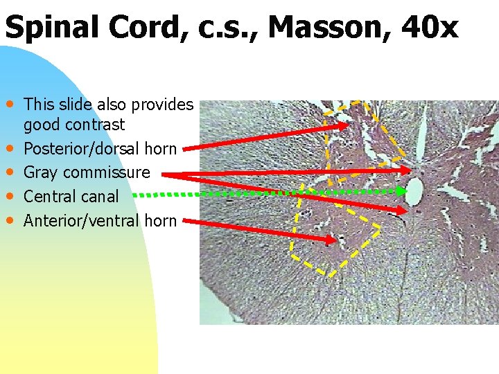 Spinal Cord, c. s. , Masson, 40 x • This slide also provides •