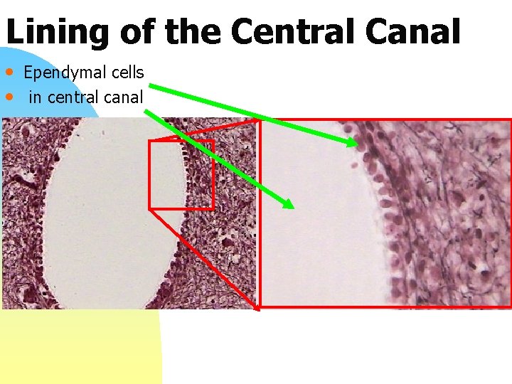 Lining of the Central Canal • Ependymal cells • in central canal 