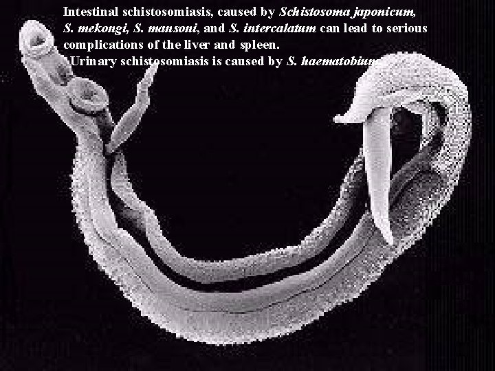 Intestinal schistosomiasis, caused by Schistosoma japonicum, S. mekongi, S. mansoni, and S. intercalatum can