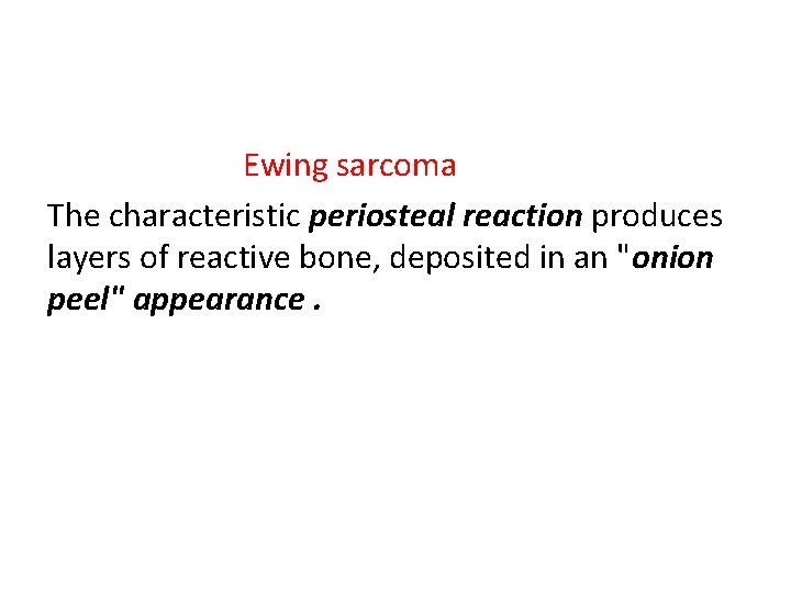 Ewing sarcoma The characteristic periosteal reaction produces layers of reactive bone, deposited in an