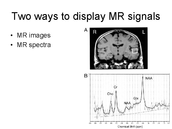Two ways to display MR signals • MR images • MR spectra 