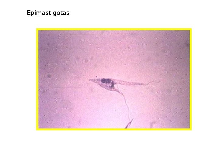 Epimastigotas 