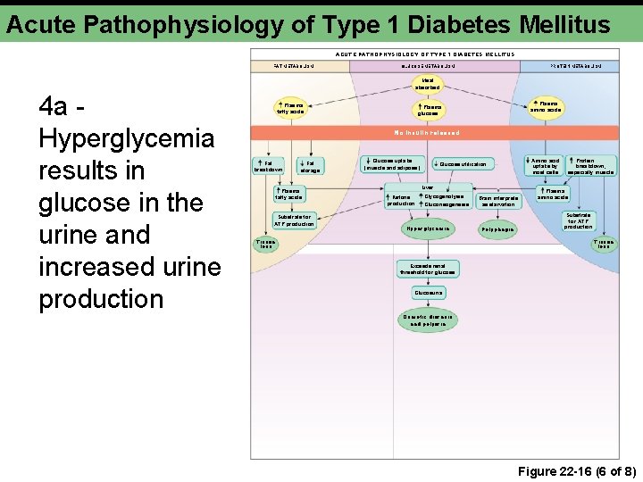 Acute Pathophysiology of Type 1 Diabetes Mellitus ACUTE PATHOPHYSIOLOGY OF TYPE 1 DIABETES MELLITUS