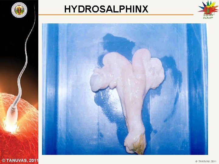 HYDROSALPHINX © TANUVAS, 2011 