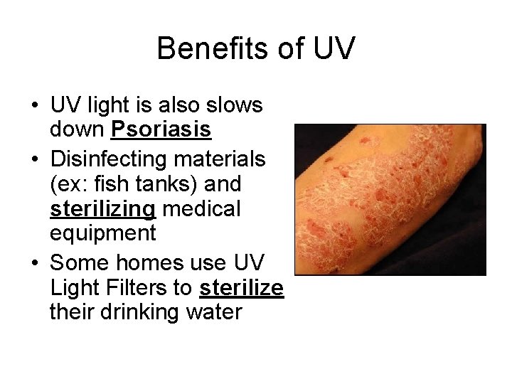 Benefits of UV • UV light is also slows down Psoriasis • Disinfecting materials