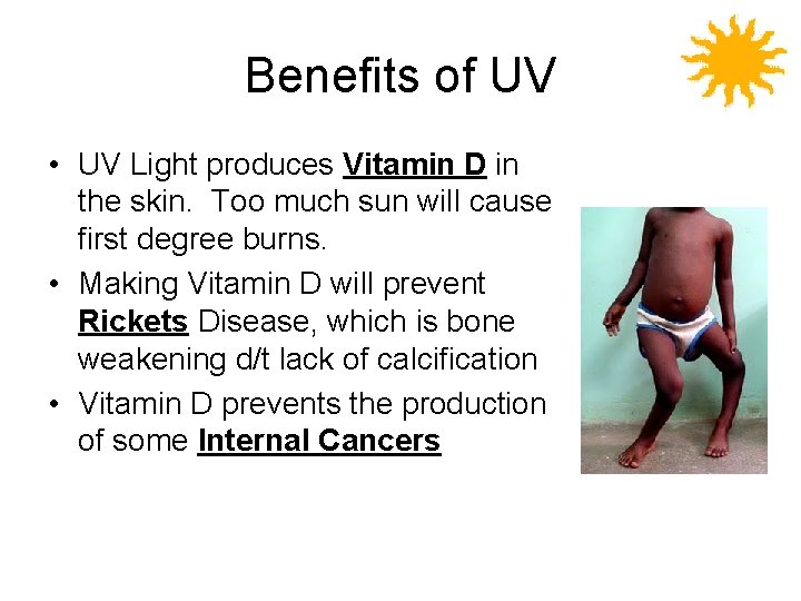Benefits of UV • UV Light produces Vitamin D in the skin. Too much