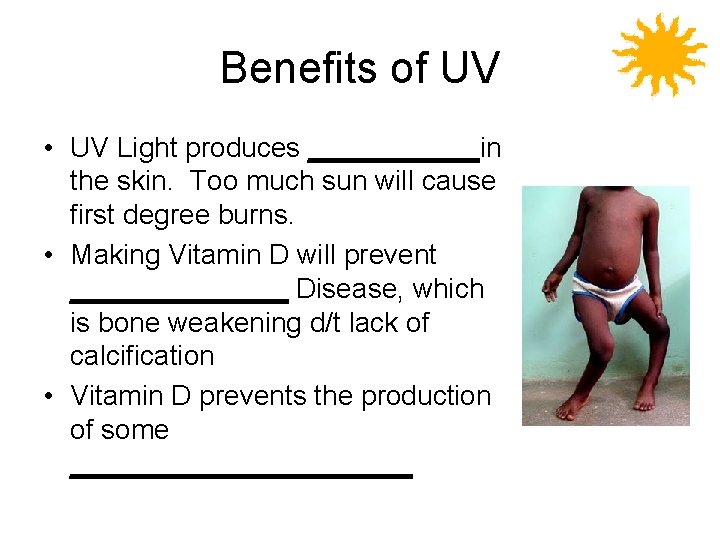 Benefits of UV • UV Light produces ______in the skin. Too much sun will