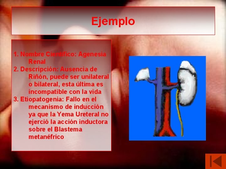 Ejemplo 1. Nombre Científico: Agenesia Renal 2. Descripción: Ausencia de Riñón, puede ser unilateral