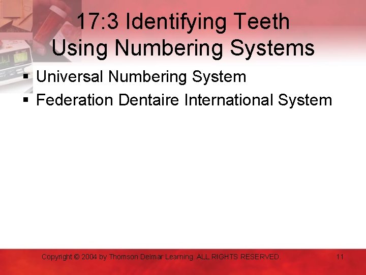 17: 3 Identifying Teeth Using Numbering Systems § Universal Numbering System § Federation Dentaire