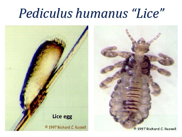 Pediculus humanus “Lice” Cause pediculosis. • Lice egg 
