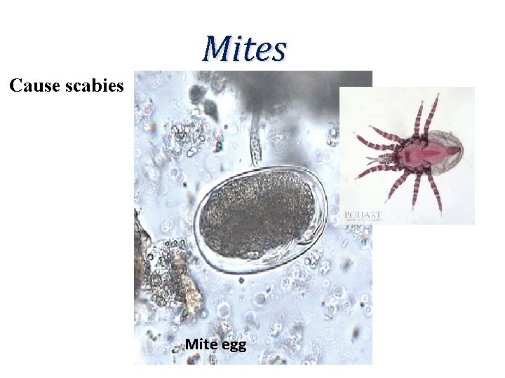 Mites Cause scabies Mite egg 