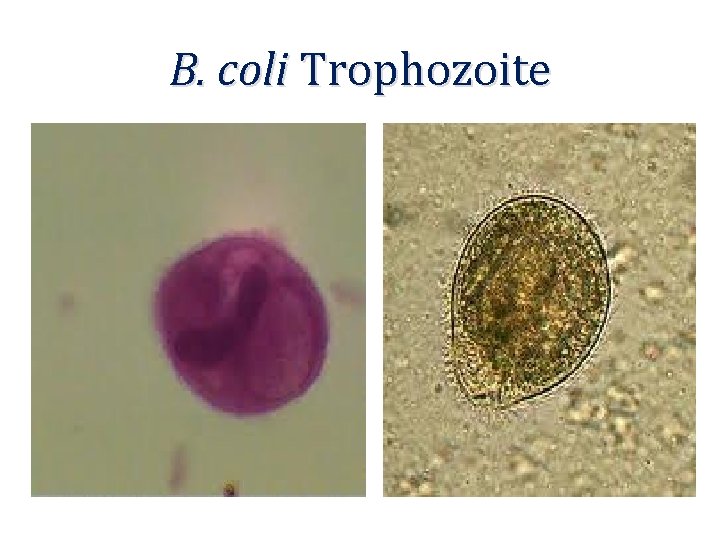 B. coli Trophozoite 