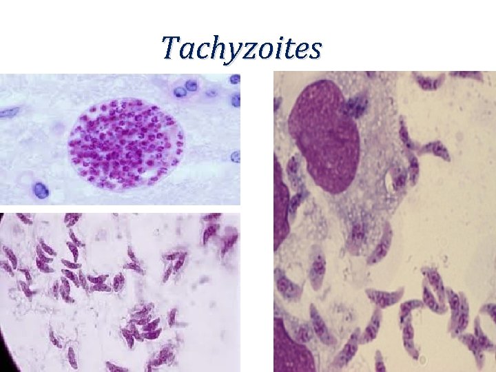 Tachyzoites 
