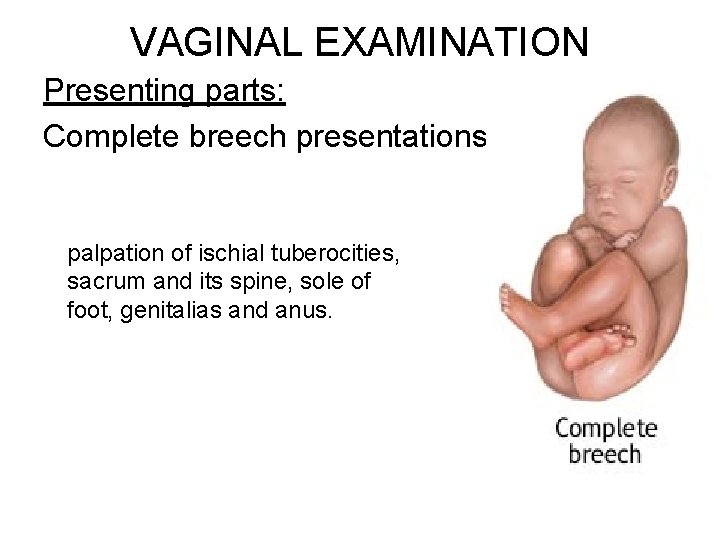 VAGINAL EXAMINATION Presenting parts: Complete breech presentations: palpation of ischial tuberocities, sacrum and its