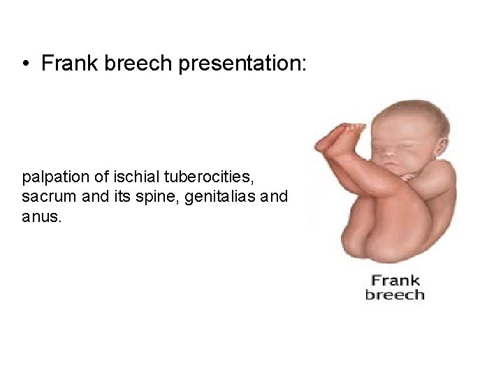  • Frank breech presentation: palpation of ischial tuberocities, sacrum and its spine, genitalias