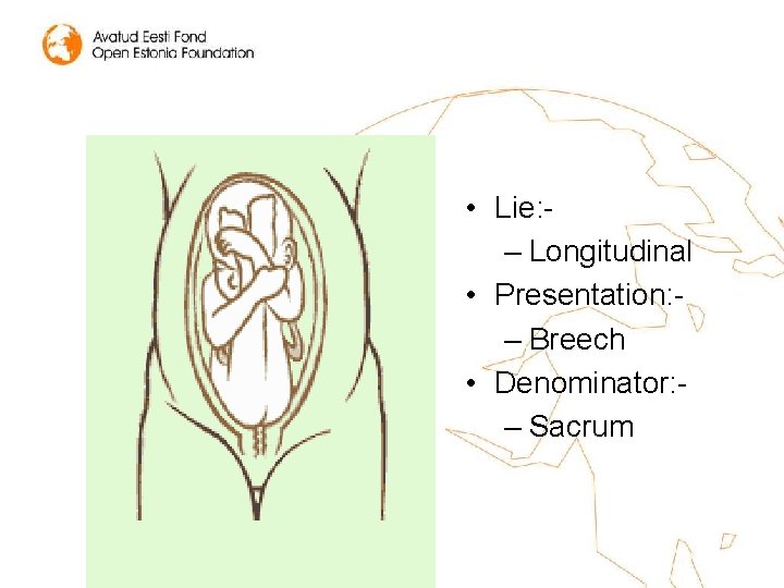  • Lie: – Longitudinal • Presentation: – Breech • Denominator: – Sacrum 
